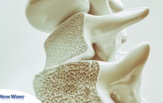 An image of a spine with the inside exposed represents osteoporosis.